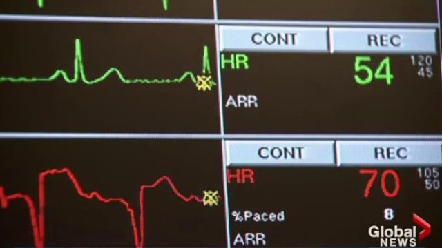 File - A Halifax woman with terminal cancer who plans to end
her life on Thursday says Canada's assisted dying legislation needs
to be improved.