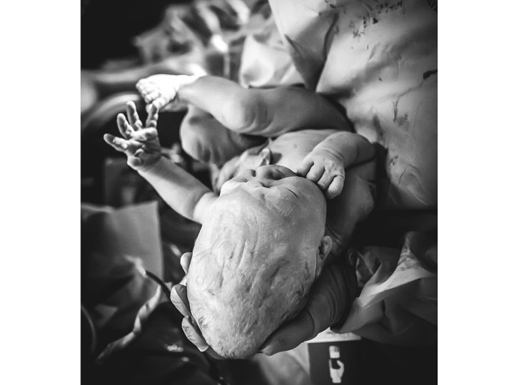 cone head baby News, Videos & Articles