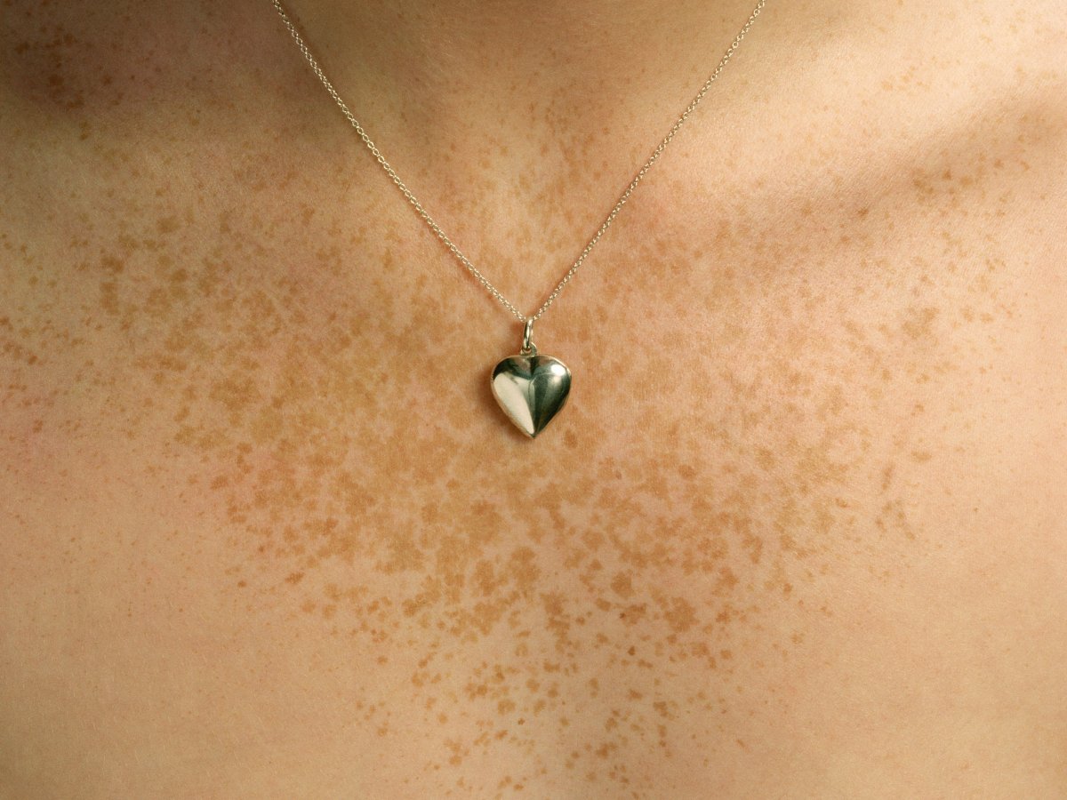 Chest freckles are an atypical sign of inflammatory breast cancer, says Dr. May Lynn Quan. Symptoms include red, swollen and pitted skin on or around the area, and a breast that feels heavy or warm. 
