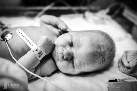 Photographer captures ‘cone head’ baby in incredible birth photos ...