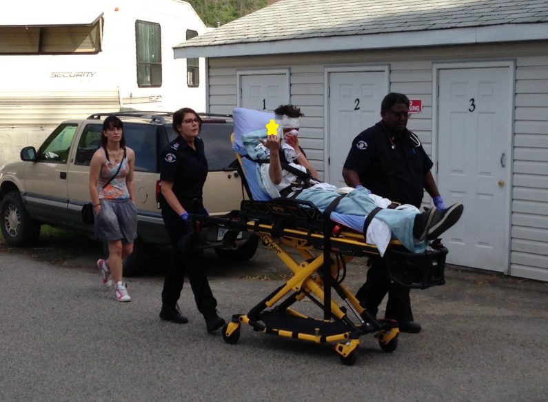 An injured man is taken to ambulance after falling through a window. 