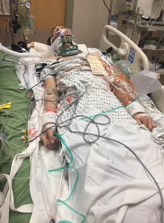 Stanley Ho, 18, is in critical condition after being hit by a vehicle on Jefferson Avenue.