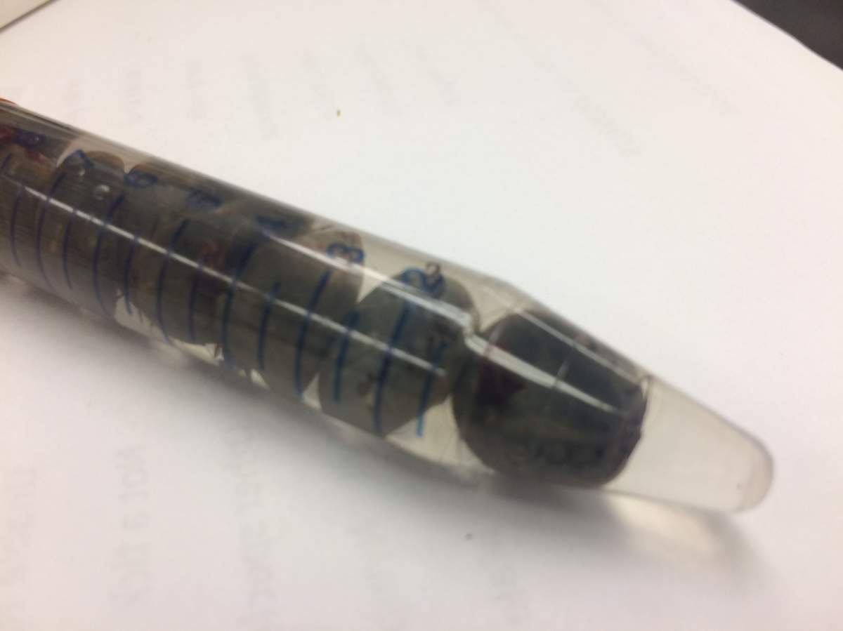 All of these ticks were removed from one dog and submitted to Alberta’s Tick Surveillance team for inspection.June 6, 2017