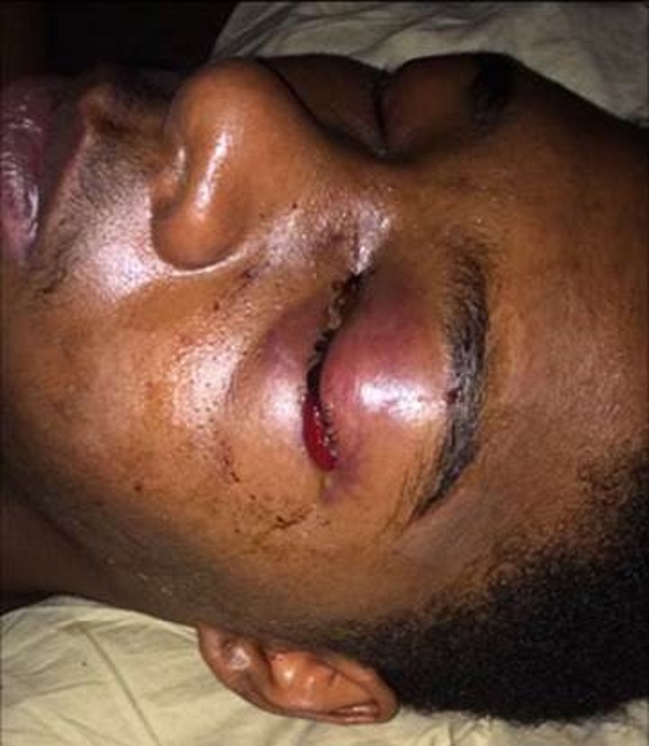 Dafonte Miller, 19, is seen in hospital after he was allegedly assaulted by an off-duty police officer on Dec 28, 2016.
