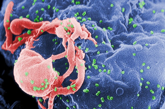 Photo shows a scanning electron micrograph of multiple round bumps of the HIV-1 virus on a cell surface.