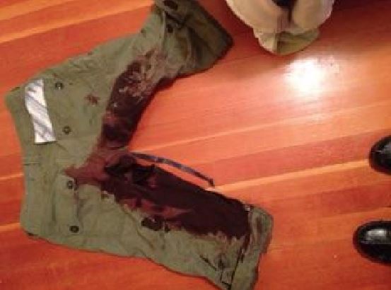 Gina Chiarelli’s shorts were left blood soaked after she managed to fight the animal off.