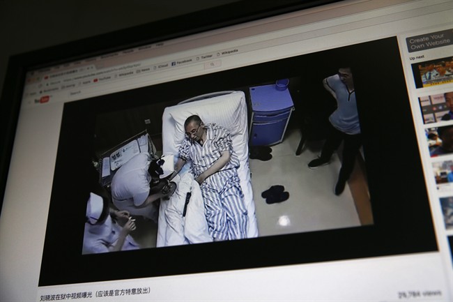 In this June 29, 2017 file photo, a video clip shows China’s jailed Nobel Peace laureate Liu Xiaobo lying on a bed receiving medical treatment at a hospital on a computer screen in Beijing.
