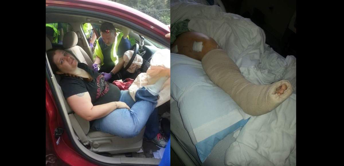 Mom’s horrific accident shows why you should never put your feet on the dashboard - image