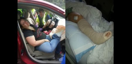 Mom’s horrific accident shows why you should never put your feet on the