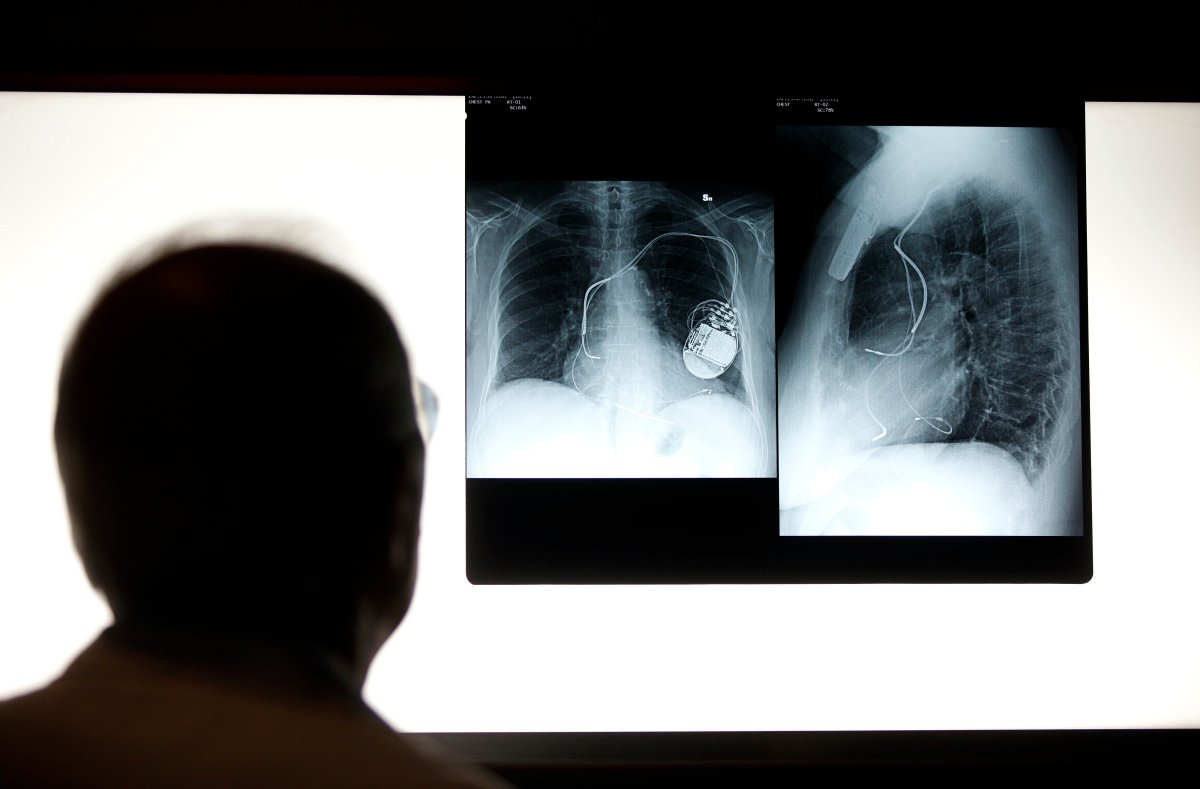 A doctor is seen examining the X-ray images of a patient's pacemaker in the radiography department at the Casa di Cura San Feliciano hospital, in this arranged photograph in Rome, Italy, on Monday, July 23, 2012.