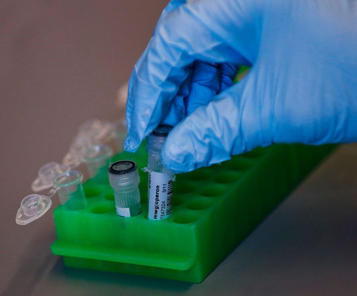 Matthew Porteus, 51, professor of pediatrics at Stanford School of Medicine, holds test tubes of DNA to use for gene editing of stem cells at Lokey Stem Cell lab at Stanford University in Stanford Calif., on Dec. 18, 2015.