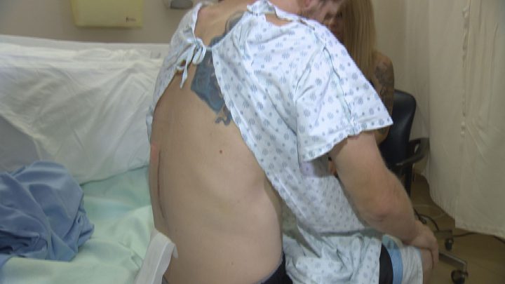 Saskatchewan man lucky to be alive after frightening weekend accident - image