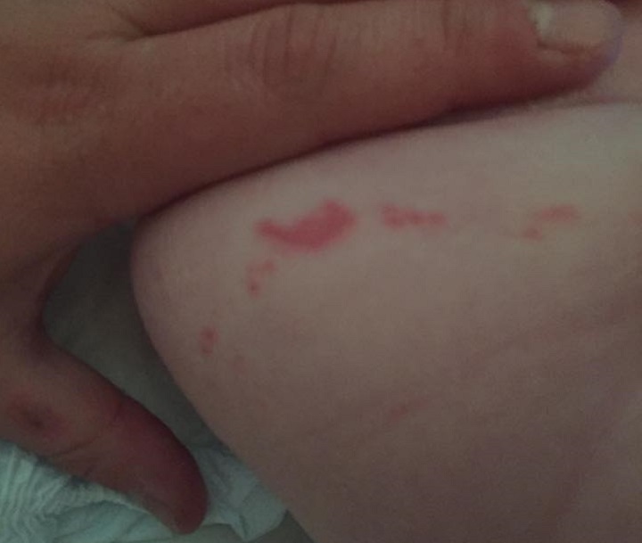 rash from new Pampers diapers 