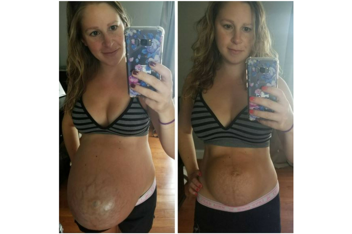Mom shares postpartum photo to show 'realistic' side of giving