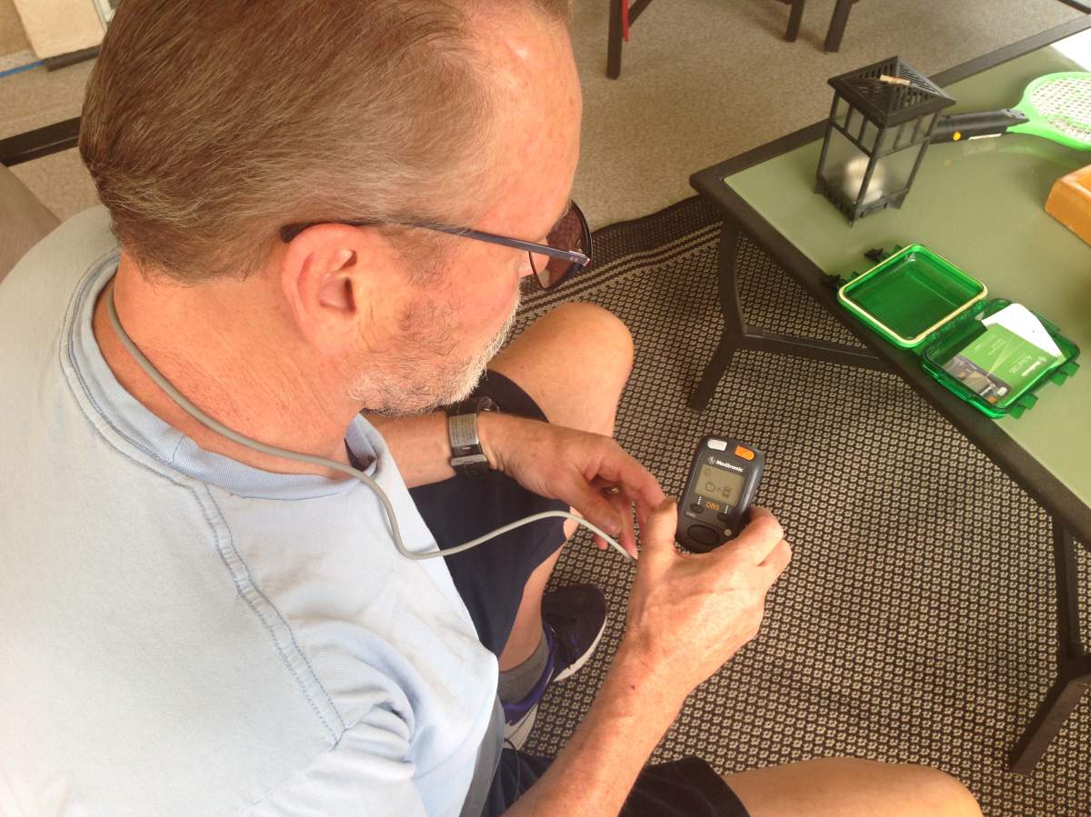 Kelowna man with Parkinson’s sees drastic improvement after brain surgery - image