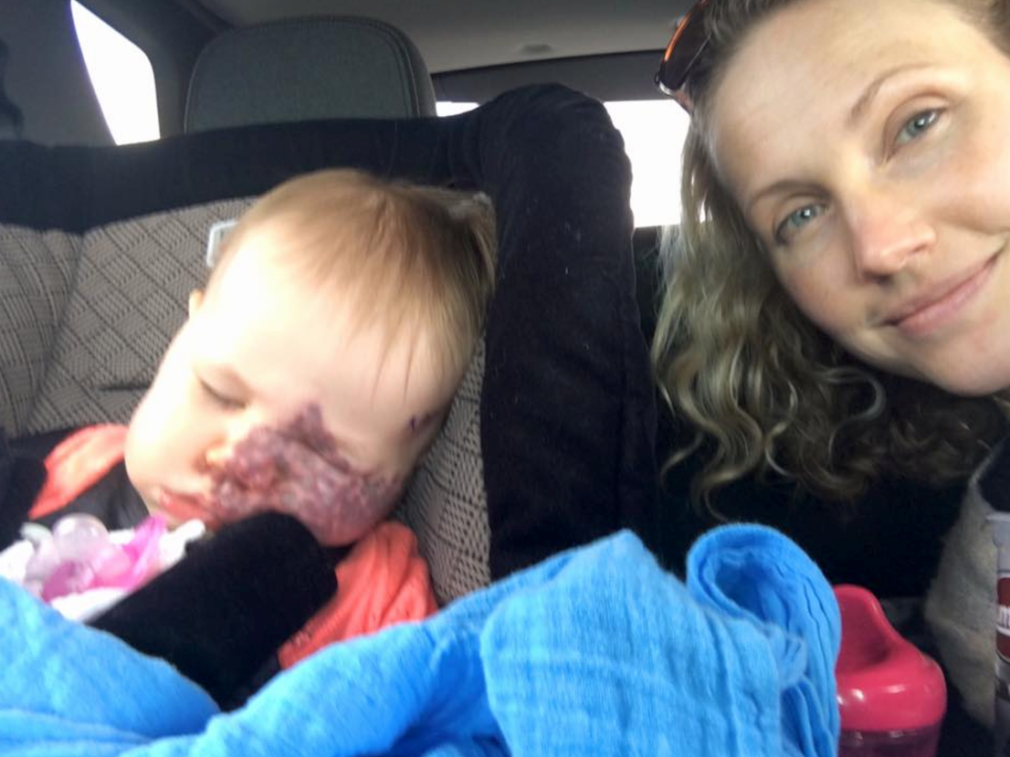 Elizabeth Klinge's picture showing her daughter post-treatment elicited a swift and sympathetic response from Facebook users. 