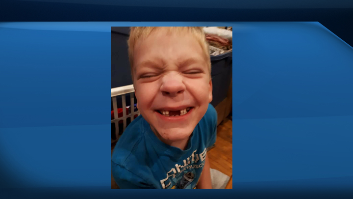 A six-year-old boy is dead after being attacked by dogs in rural Saskatchewan on Wednesday evening.