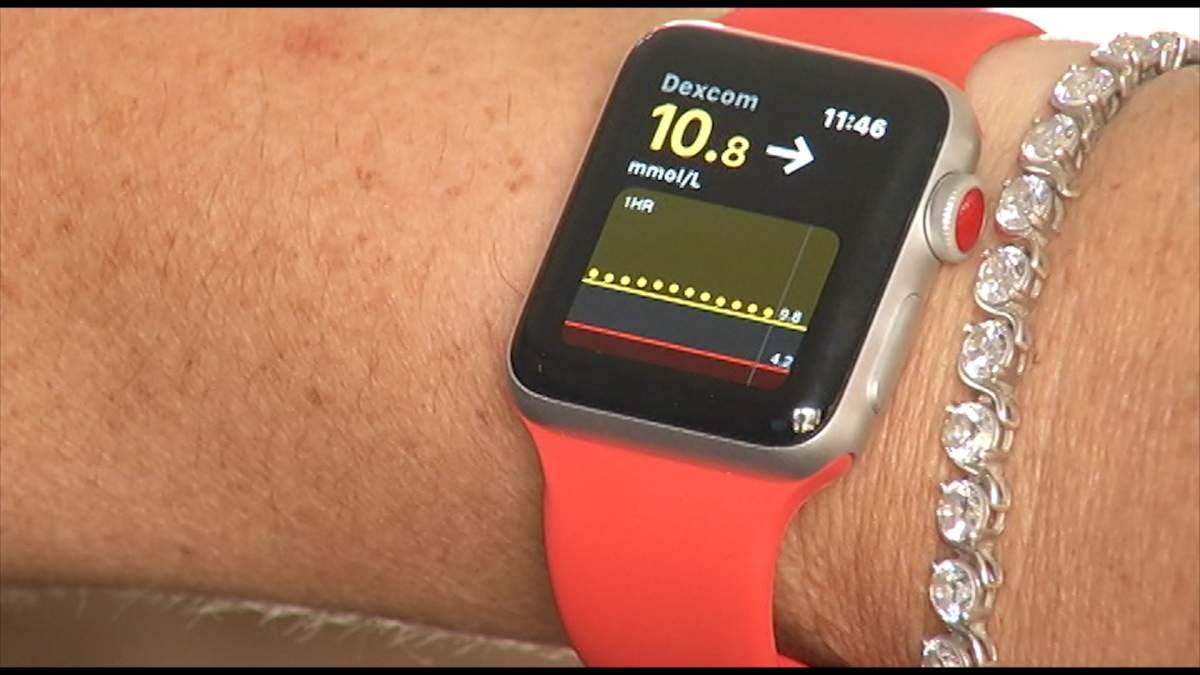 Peterborough-area woman says government clawback puts financial strain on those with Type 1 diabetes - image