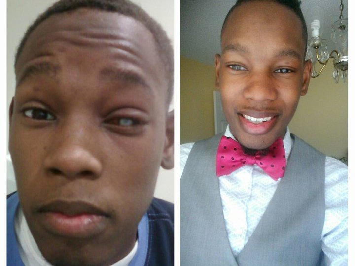 Why you shouldn’t wear coloured contact lenses this Halloween (or ever