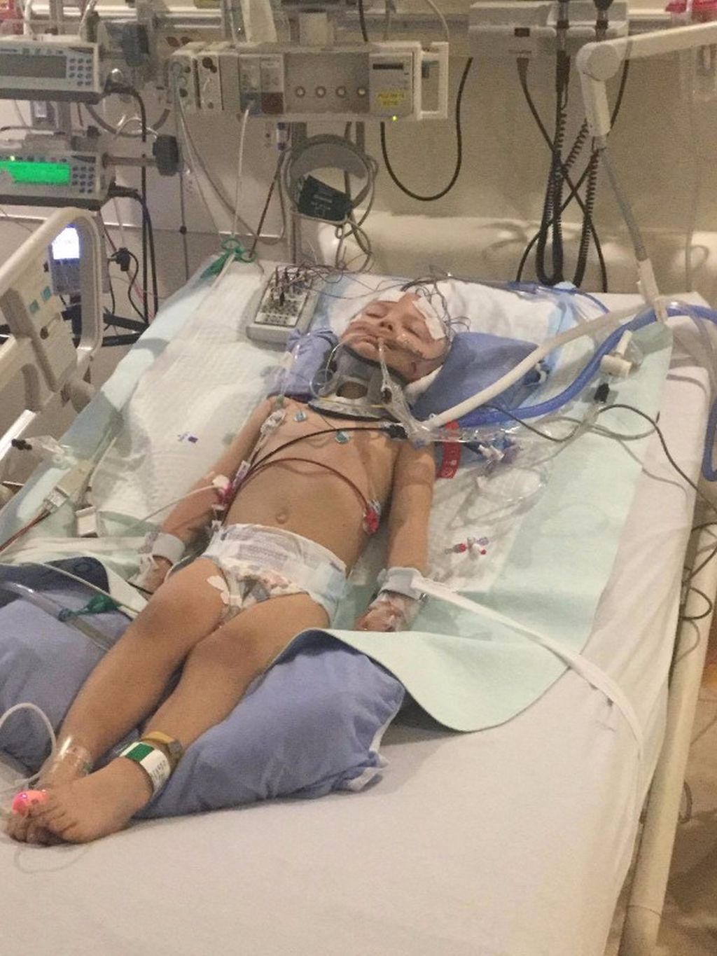 Three-year-old Ivy Wick is seen in hospital before being taken off life support. This photo was posted on a GoFundMe page.