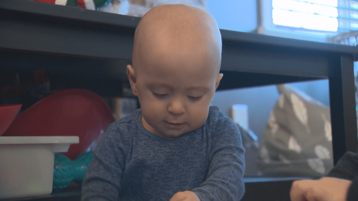 One-year-old Alex was born at 27 weeks. He is now thriving.