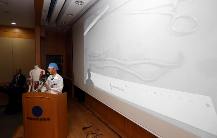 Surgeon Lee Cook-jong gives a briefing during a news conference at a hospital in Suwon, South Korea, November 15, 2017. 