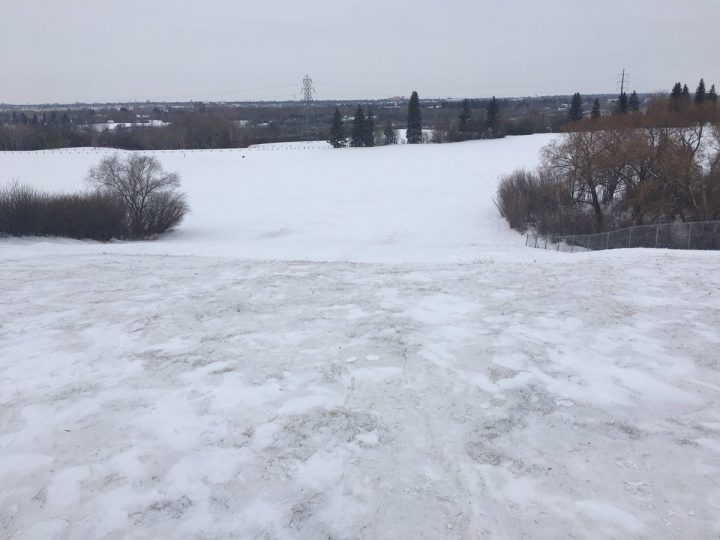 Saskatoon family seeking answers after girl breaks both legs tobogganing - image