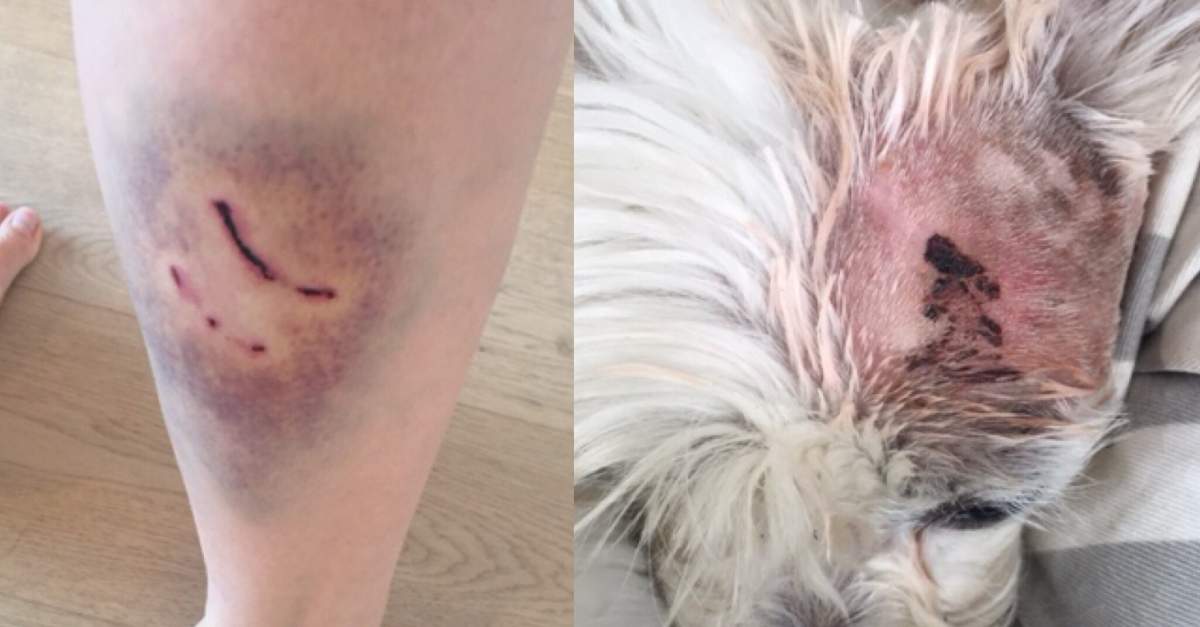 Anne Hurwitz needed a tetanus shot and her dog was rushed to the vet after the attack.