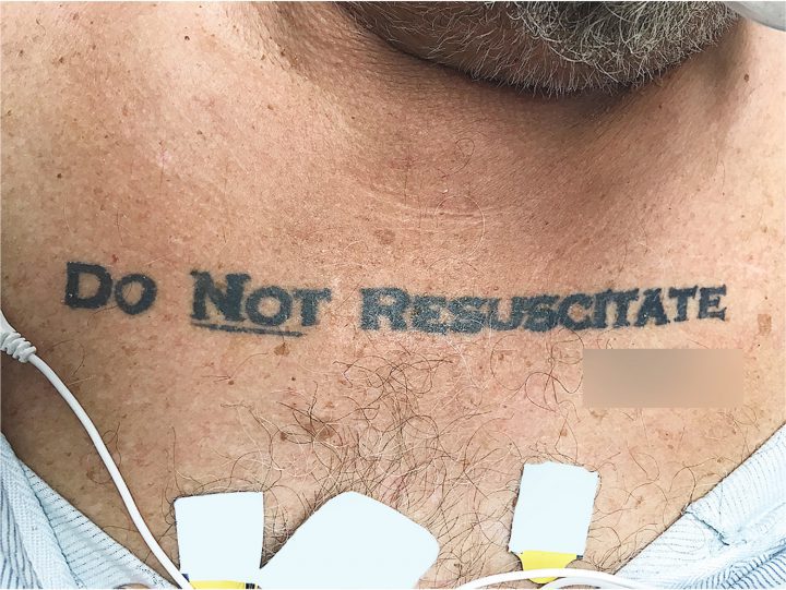 A man with a "do not resuscitate" tattoo prompted an ethics conundrum for doctors.