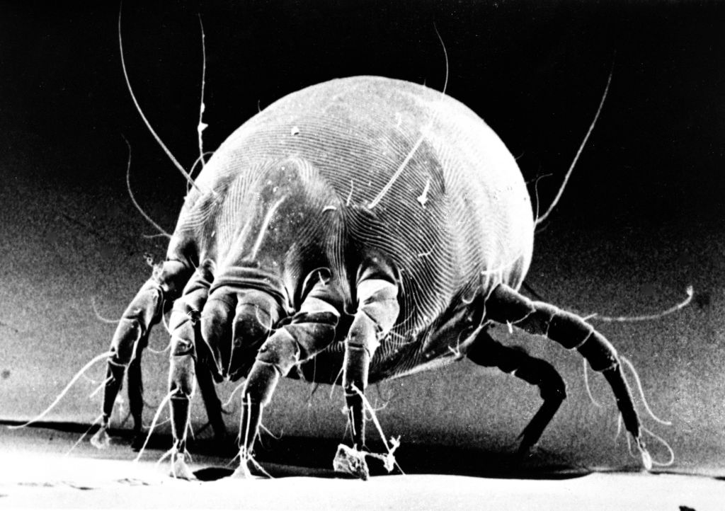 A woman’s dirty pillow gave her eyelash mites; here’s what you need to