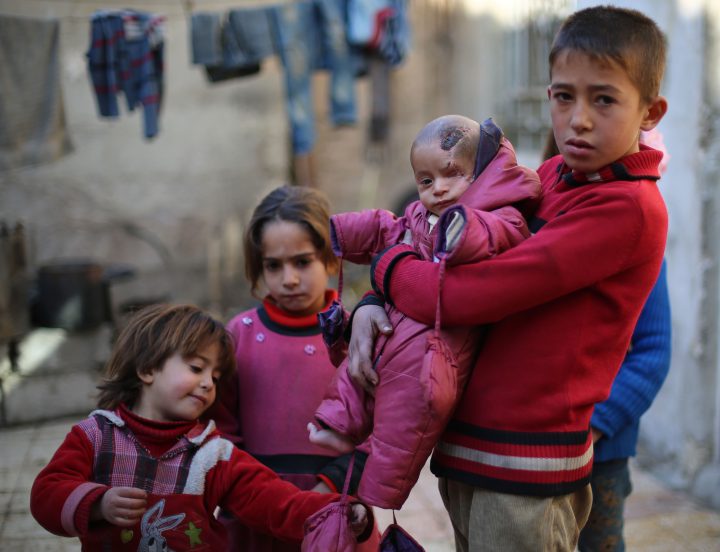 A Syrian baby, Karim, is seen with wounds on his head in besieged Damascus suburb of Eastern Ghouta, Syria on Dec. 15, 2017.