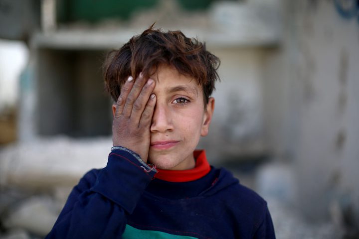 A Syrian child holding hand cover his eye in support of Syrian baby Karim, poses for a photo, in besieged Damascus suburb of Eastern Ghouta, Syria on Dec. 19, 2017.