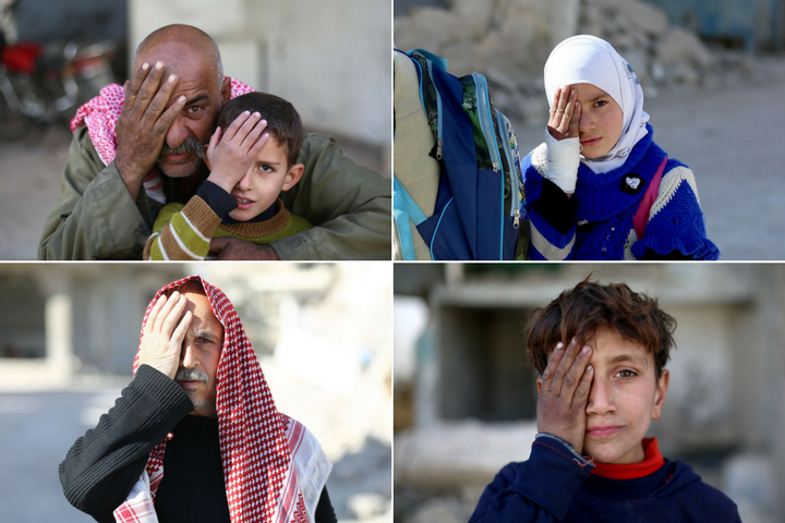 Syrians are covering their eyes in solidarity with a baby who was injured by violence.