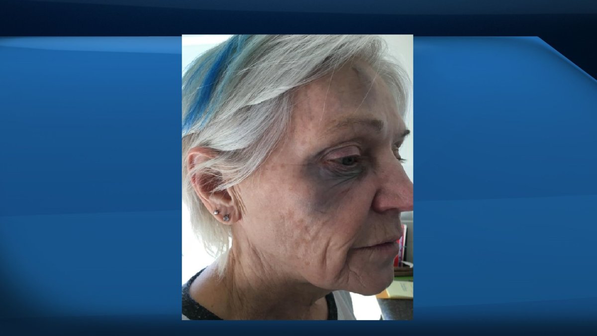 Donna Courage, a town councillor in Claresholm, Alta. alleges she was assaulted in her own home on Saturday.