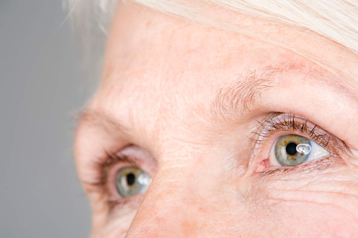 About one million Canadians have age-related macular degeneration.