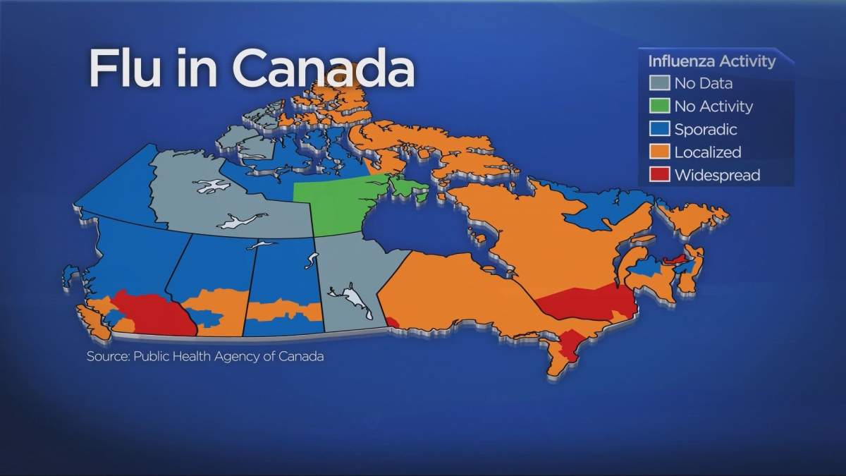 Federal health officials are currently listing Montreal as being in a “widespread” flu area.