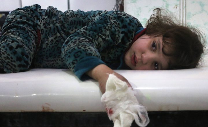 A lightly wounded Syrian girl lies on a stretcher.