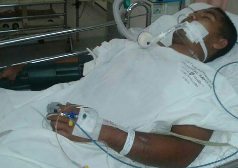 Collect picture of Abu Zarin Hussin in hospital after being bitten by his pet King Cobra in Kelantan, Malaysia.