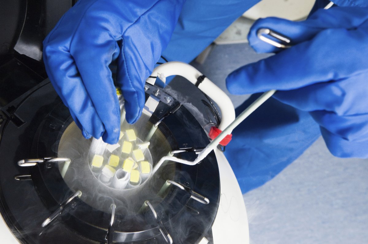 FILE - Doctors hands removing embryo samples from cryogenic storage, Fertilized embryos are stored in liquid nitrogen filled tanks to keep them as new if patients require them at a later date. 