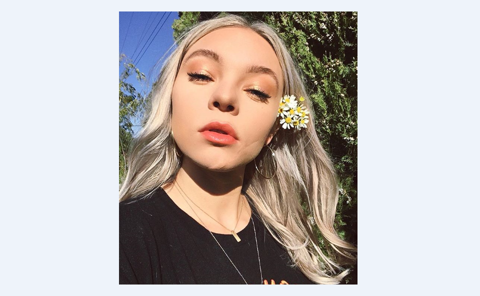 Kelowna actress Taylor Hickson is suing a production company after an on-set injury left her scarred.