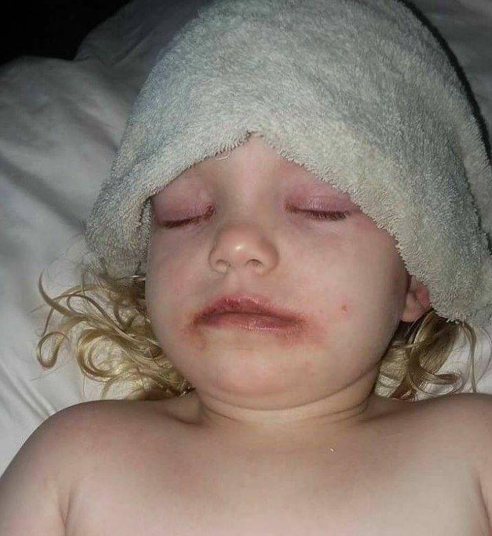 3yearold hospitalized after suffering severe reaction to kids