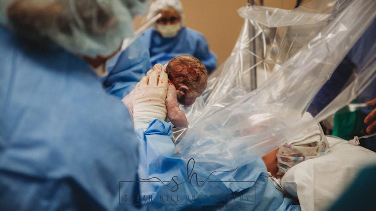 Kentucky midwife helps deliver own baby via Csection National