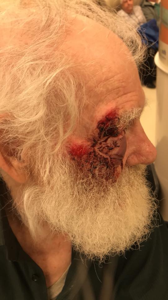 Sid\’s injury when Mariam first found him. Credit: Mariam Roya.