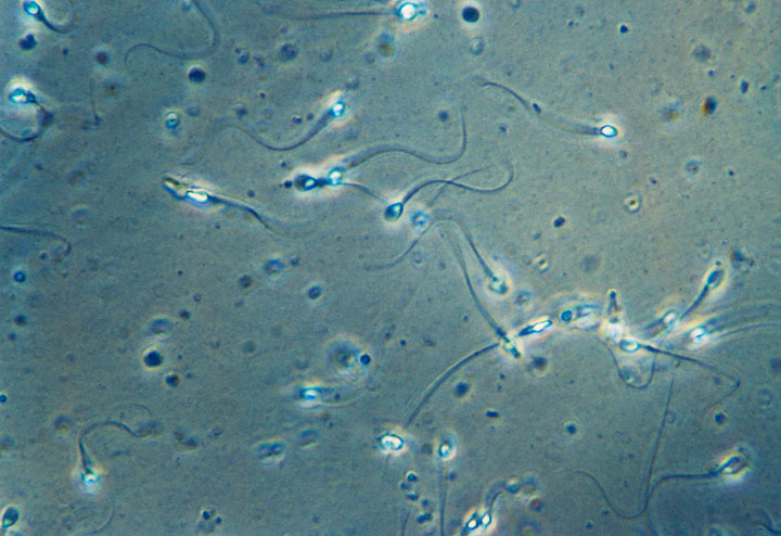 Human spermatozoa.