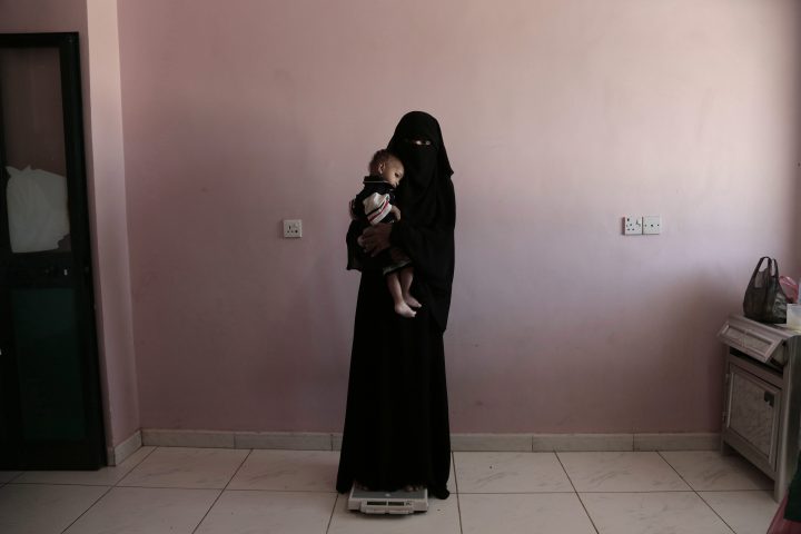 Umm Mizrah, a 25-year-old Yemeni woman, holds her son Mizrah on a scale in Al-Sadaqa Hospital in the southern Yemen city of Aden in this Feb. 13, 2018 photo.