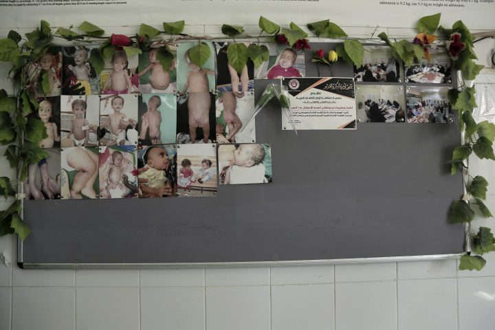 This Feb. 13, 2018 photo shows photographs of severely malnourished infants hung on wall in the administrative office at the Aden Hospital, in Yemen.