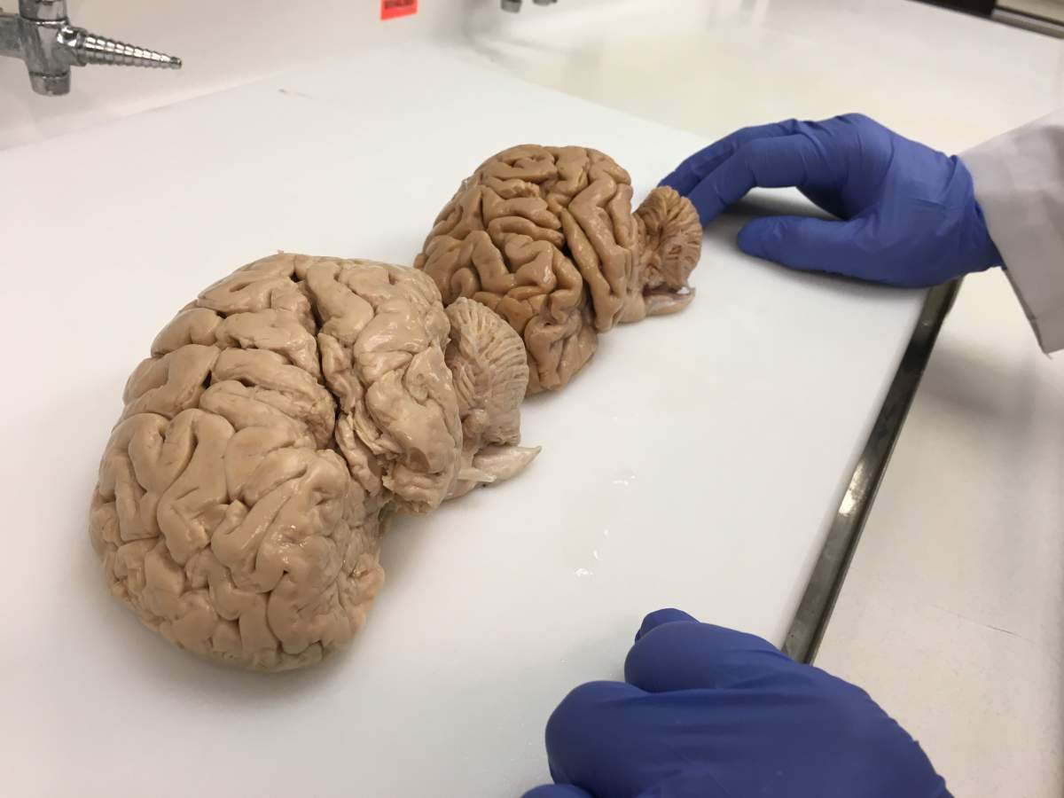 Matt Gurney set out to find the name of the song stuck in his head, and along the way he learned a lot about how memory works.