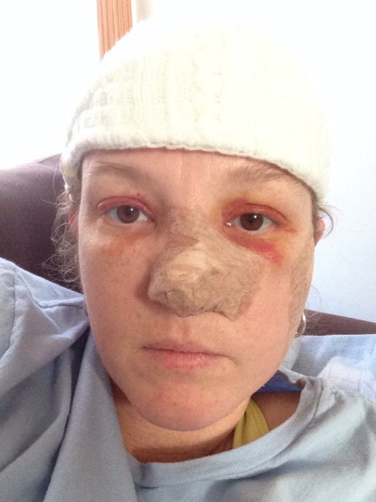 Woman opens up about surviving 86 skincancer surgeries ‘I don’t have