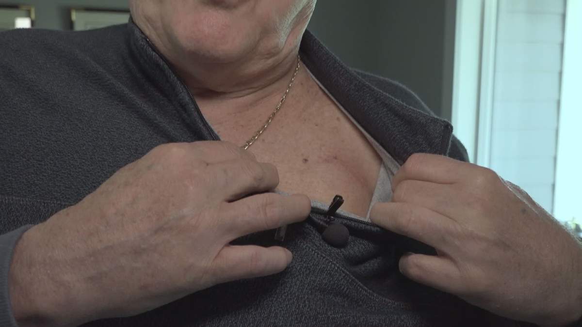 Earl Morris now has a pacemaker to deal with any future problems.

