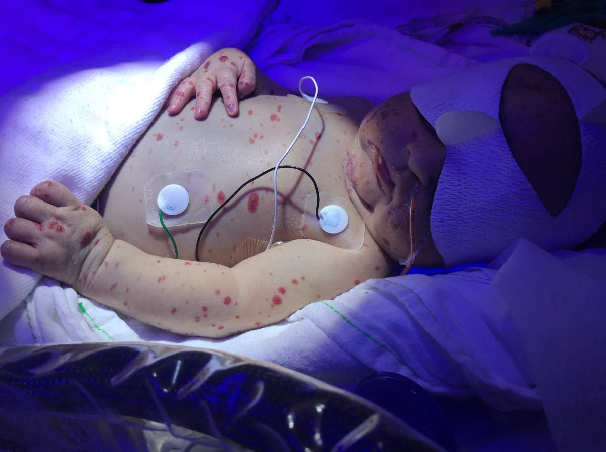 Dominic shortly after he was delivered.